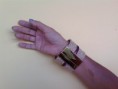 Bracelete